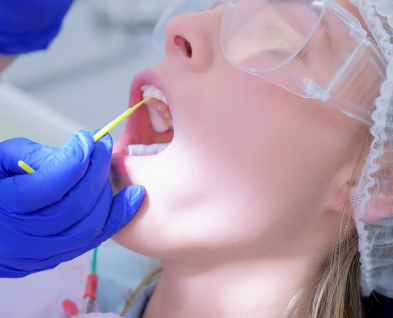 Fluoride Treatment