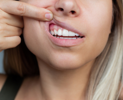 Periodontal Care