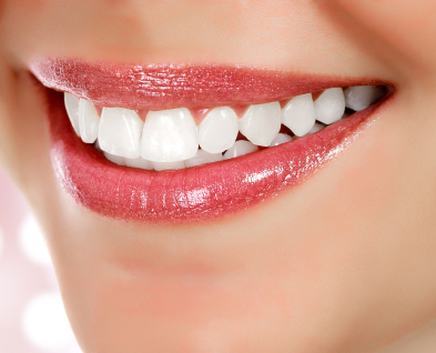 Teeth Whitening